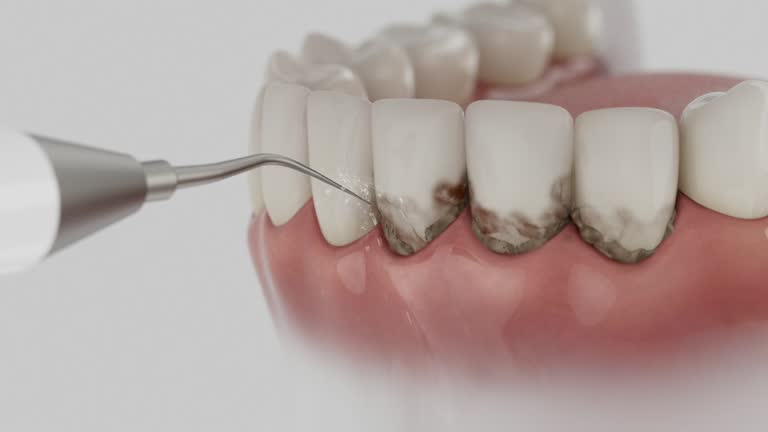 Reliable Teeth Cleaning And Checkup contractor in Loudoun County County, VA by Dentist Open Now